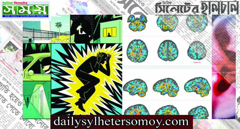 ‘হাভানা সিনড্রোম’ রোগের কারণ শনাক্ত