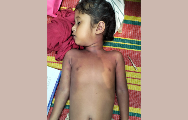 মাধবপুরে সাপের কামড়ে শিশুর মৃত্যু