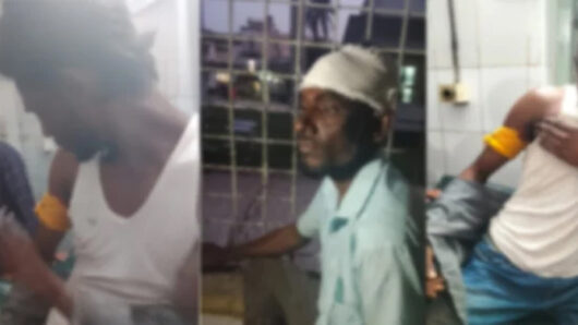 দিরাইয়ে ধান শুকানোর খলা নিয়ে সংঘর্ষে আহত- ২০