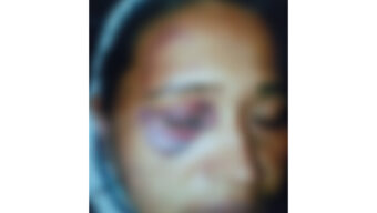 জৈন্তাপুরে স্বামীর বিরুদ্ধে একাধিক বিয়ে ও নির্যাতনের অভিযোগ, আদালতে মামলা